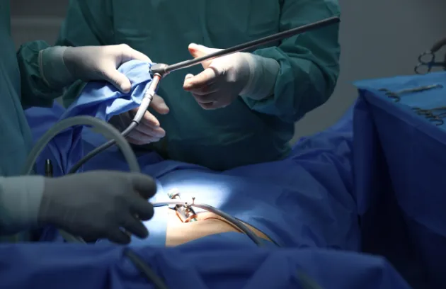 Surgical team performing a laparoscopic procedure